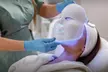 Higiene facial completa y opción a microdermoabrasión, radiofrecuencia o máscara led para 1, ahorra hasta un 67% - Image 2