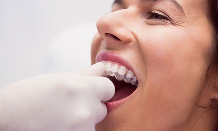 Férula de descarga semirrígida - Clinica Dental Estetica Ident Lab