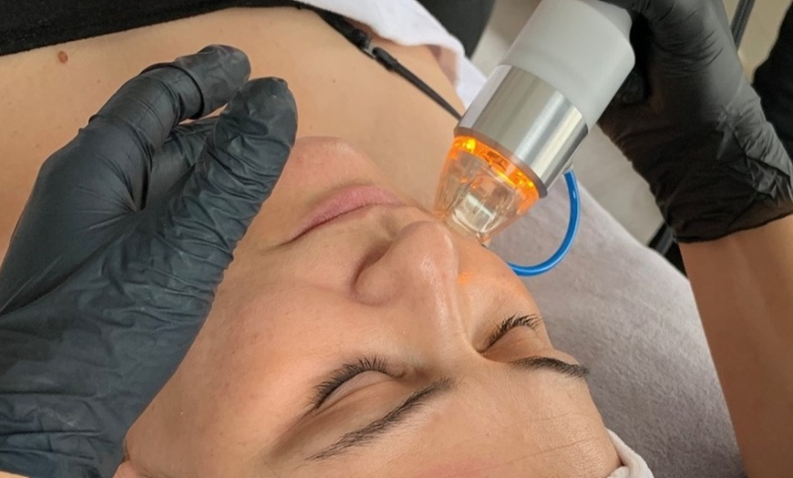 Image 1: 1 oder 2x 60 Min. Radiofrequenz-Microneedling inkl. Seren für 1 Person