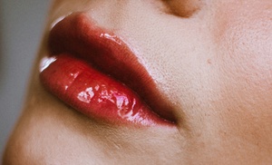 Hyaluronpen con hidratación o relleno de labios y reafirmación facial Hyaluronpen con hidratación o relleno de labios y reafirmación facial