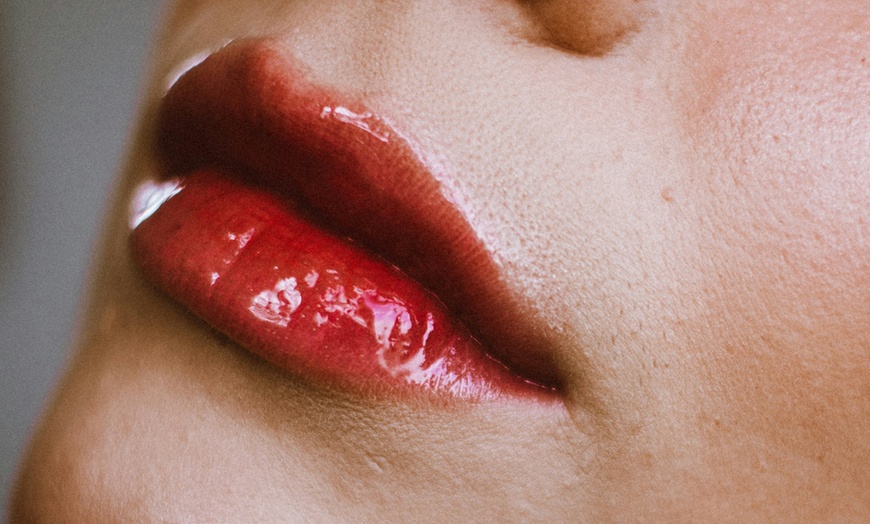 Image 1: Hyaluronpen con hidratación o relleno de labios y reafirmación facial