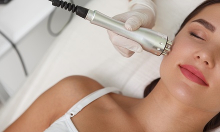 1 sesión de higiene facial con radiofrecuencia - María Silva Estética Avanzada