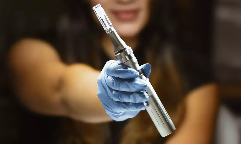 1, 2 or 3 Micro-Needling Treatment w/ Hyaluronic Acid Treatment & More