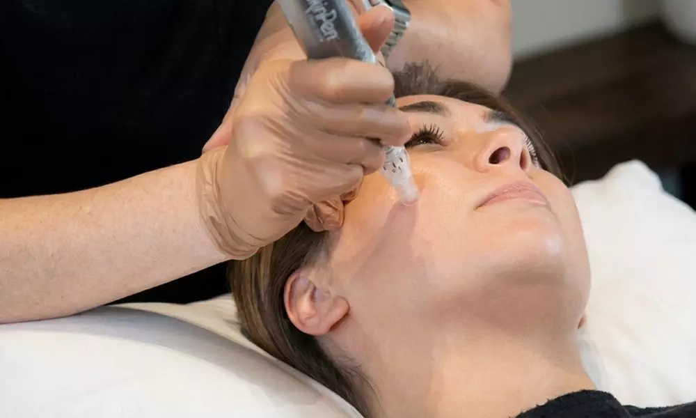 Non-Surgical Augmentation for Refreshed, Youthful & Contoured Look