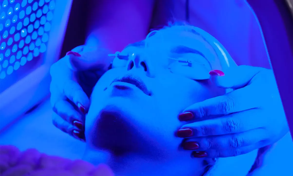 1 o 2 sesiones de lifting facial sin cirugía y opción a higiene facial