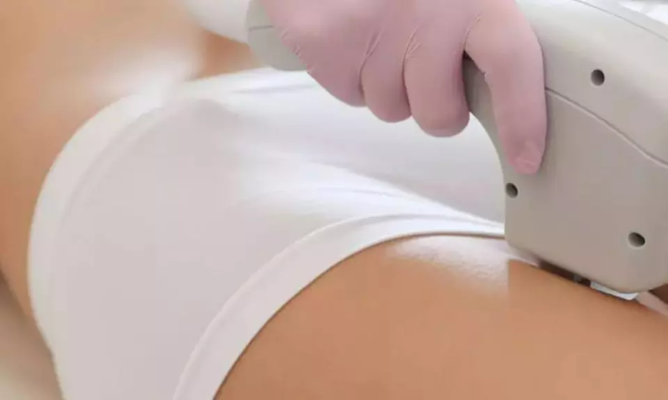 5 séances d’épilation à la lumière pulsée sur une zone au choix avec Beauté De L'Arc (jusqu'à 75% de remise) - Primary Image