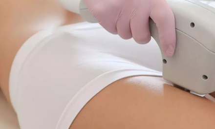 5 séances d’épilation à la lumière pulsée sur une petite zone - Beauté De L'Arc