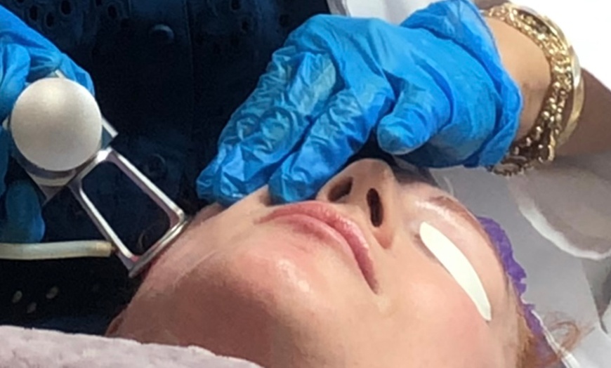 Image 4: Up to 57% Off on Laser Skin Resurfacing at Fiori di Lino MedSpa