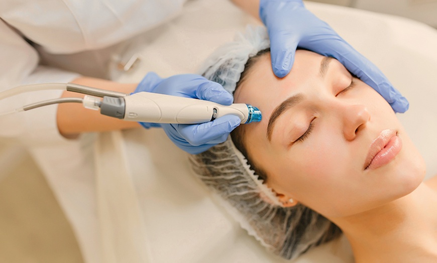Image 1: 1, 2 o 3 sesiones de microlifting facial de vitaminas con Dermapen