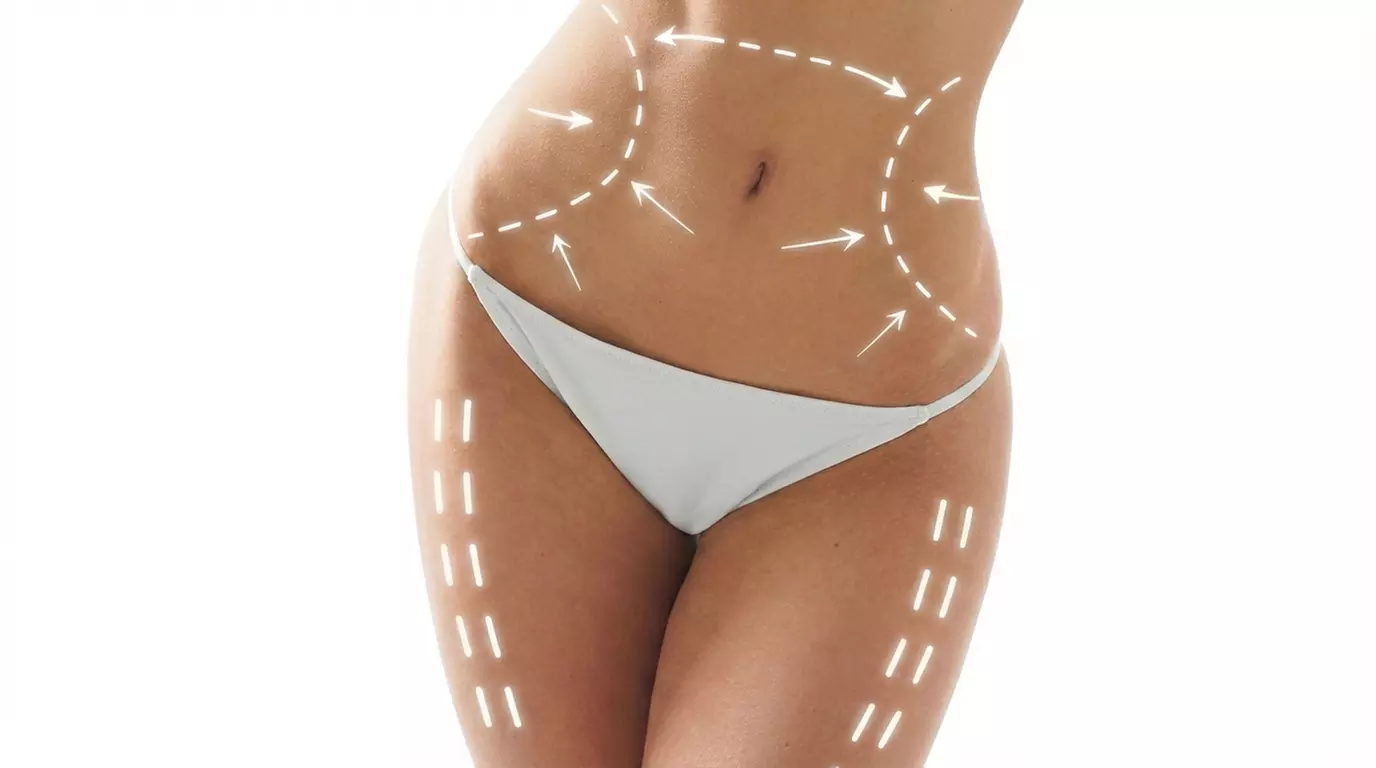 Tratamiento corporal con cavitación, presoterapia y opción a lipoláser