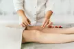 Up to 55% Off on Acupuncture at One Med - Second Medium
