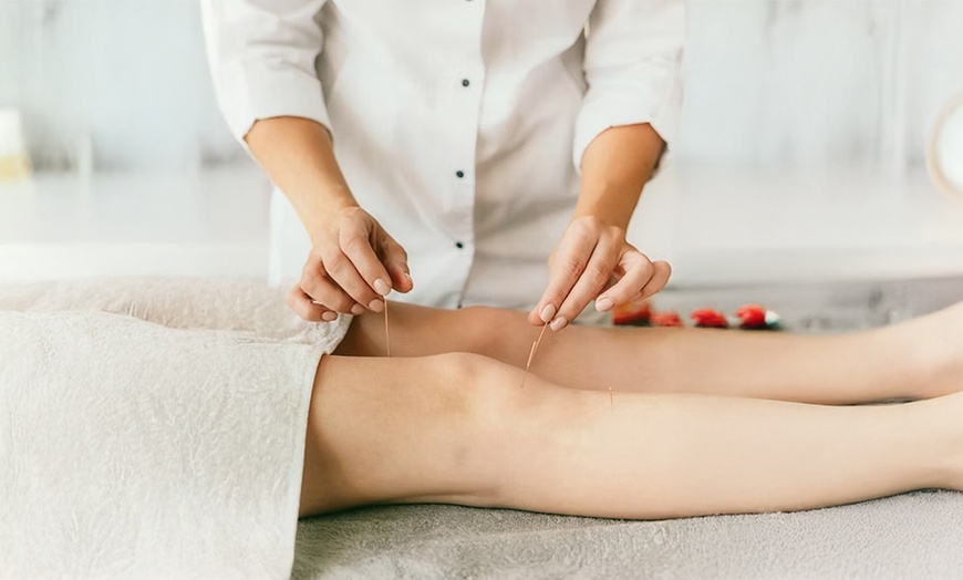 Image 2: Up to 55% Off on Acupuncture at One Med