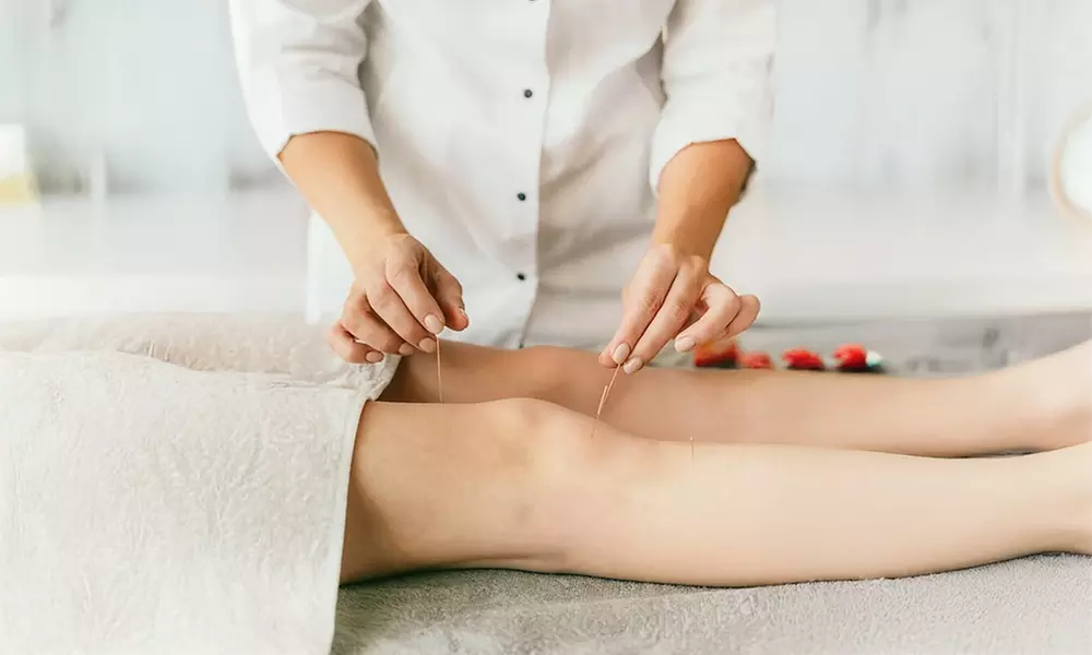 Up to 55% Off on Acupuncture at One Med