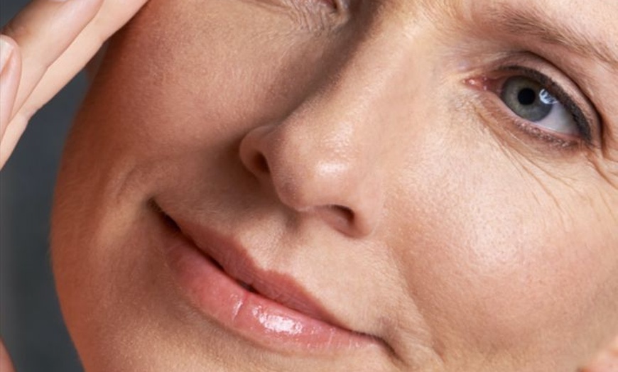 Image 2: Plump, Smooth & Glow: 0.5, 1 or 2 ml Dermal Filler with Consultation