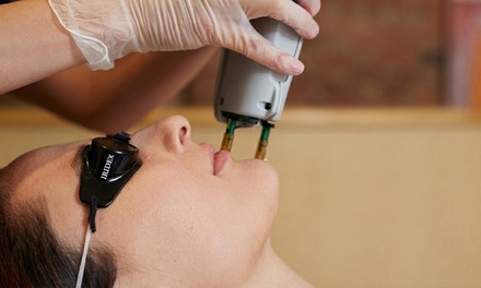 One IPL Skin Rejuvenation Treatment - Glamour and Grace Spa