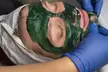 45 - 75 Min. klassische Gesichtsbehandlung, Mikrodermabrasion oder Microneedling für 1 Person (bis 31% sparen) - Second Medium