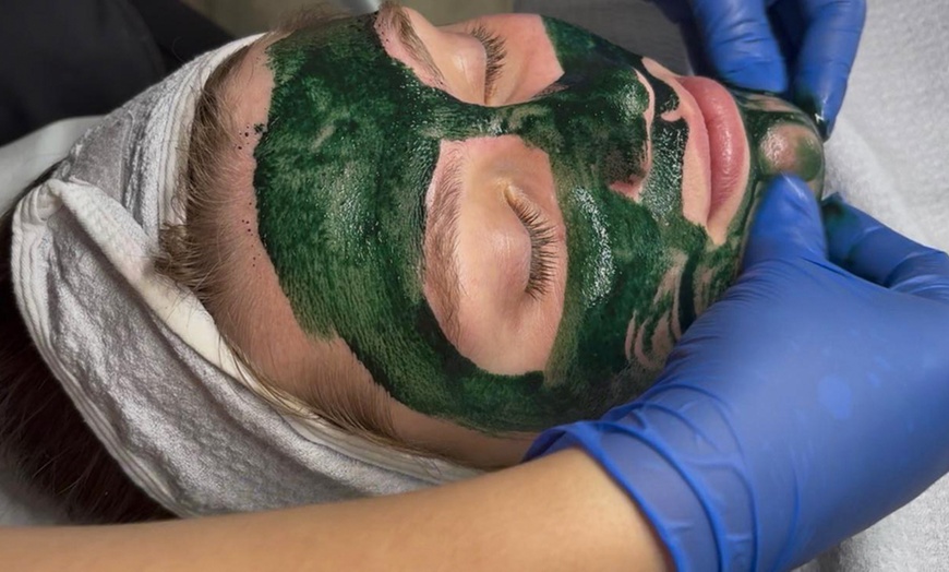 Image 2: Klassische Gesichtsbehandlung, Mikrodermabrasion oder Microneedling