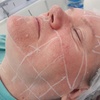 Image 3: Lift and Tone with Advanced HIFU for Face With or Without Neck