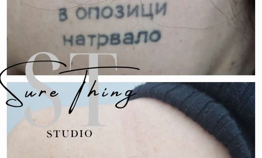 Image 6: Up to 86% Off on Tattoo Removal at Sure Thing Studio