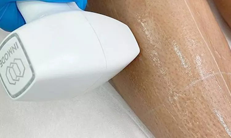 Flaunt Smooth Skin w/ 3 Laser Hair Removal Sessions on Area of Choice