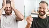 Get Medical Marijuana Card Evaluation at EZMEDCARD - Medical Marijuana Doctors of Massachusetts (MA)