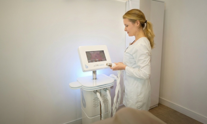 Image 2: One or Two Sessions of Full Face HIFU Treatments