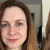 Image 1: Plasma Fibroblast Lift for Lips, Eyelids, or Smile Lines (30-60 Min)