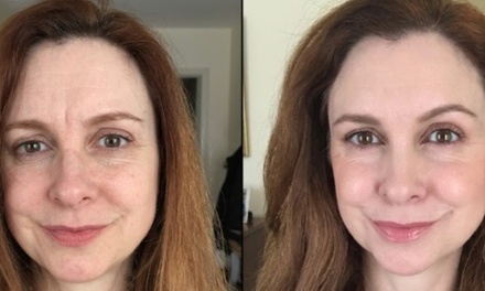 One Plasma Fibroblast Lift for Upper or Lower Lip - Monarch Beauty Studios