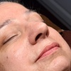Image 1: Relax with One, Two, or Three 60-Minute HydraFacial Sessions