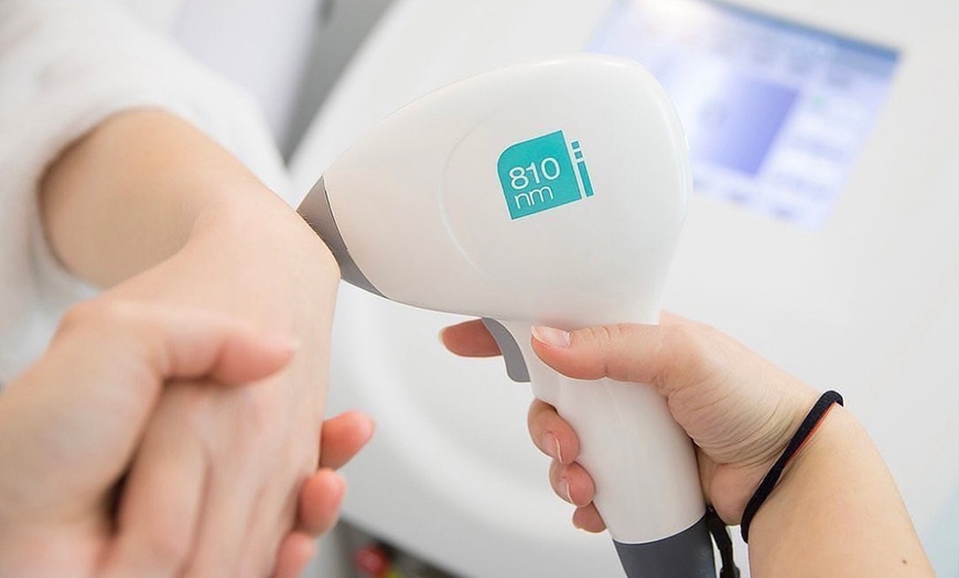 Image 1: Laser Hair Removal for Various Body Areas in Three or Six Sessions