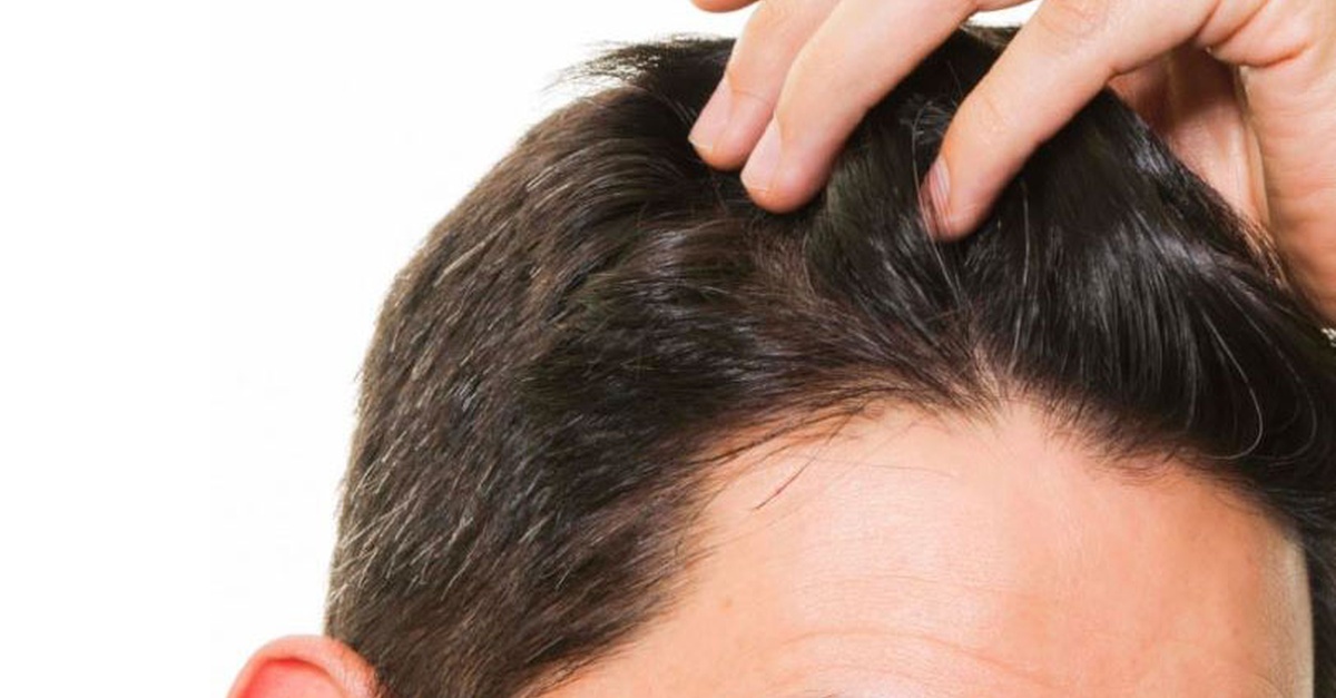 Sesión de bioestimulación en cuero cabelludo en Madrid