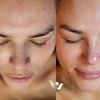 Image 2: Up to 60% Off Facials with Dermaplaning at Vibrance Med Spa