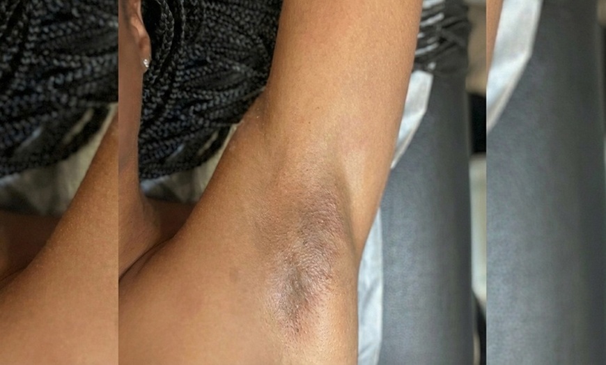 Image 6: Get Silky Smooth Skin with One, Three, or Five Bikini Waxing Packages