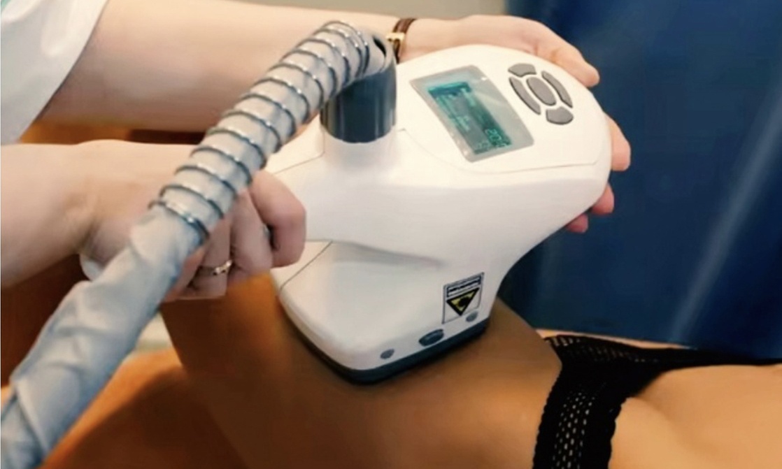 Get 2,4,6,or 8 Thermal Contour Cellulite Reduction  Treatments