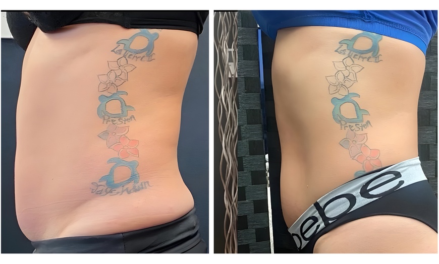 Image 6: 1, 3 or 6 Signature Body Contouring Sessions of Your Choice 45 -90 Min