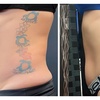 Image 6: 1, 3 or 6 Signature Body Contouring Sessions of Your Choice 45 -90 Min