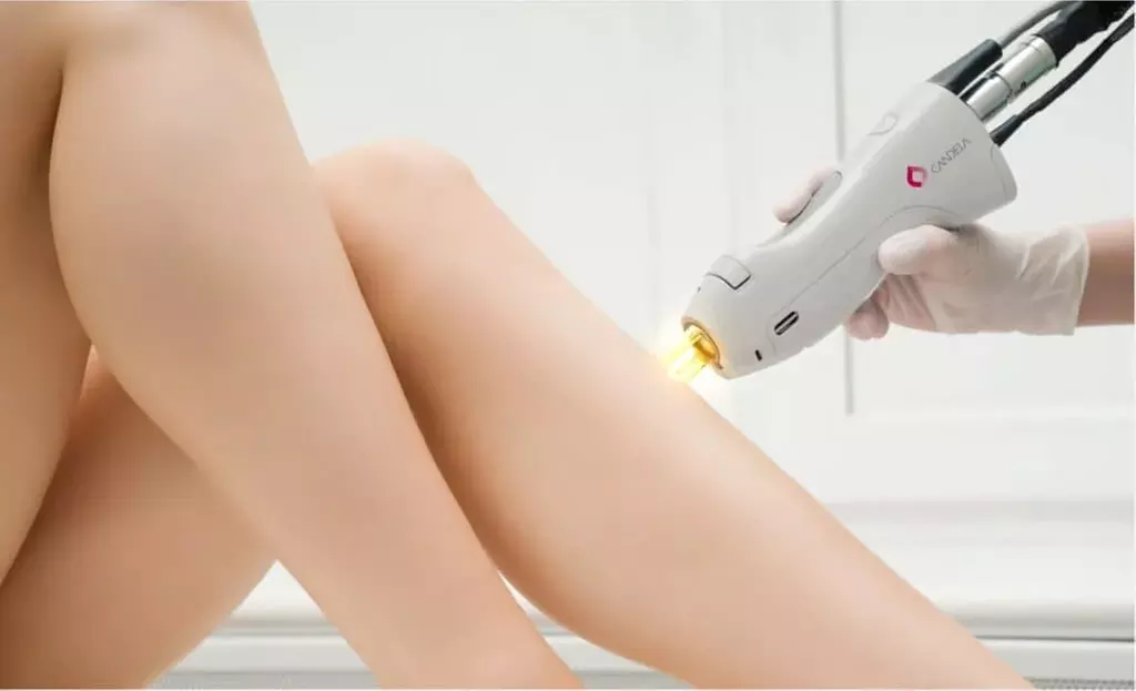 State-of-the-Art Tech for 6 Laser Treatment Sessions on Select Areas at DermaGlow MedSpa (Up to 55% Off)