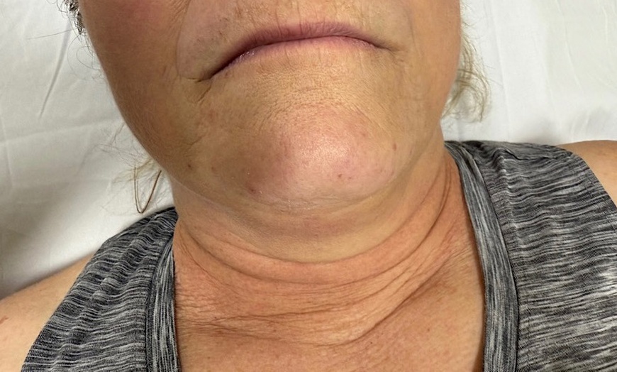 Image 2: Relax with Cryo & Thermal Body sculpting (2 or 3 sessions)