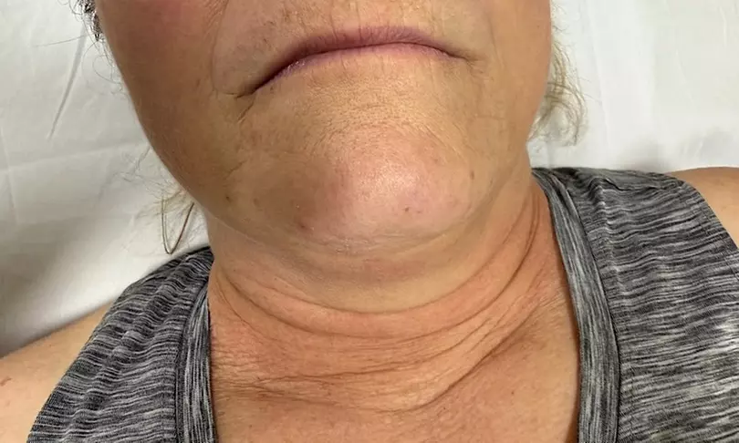 Relax with Cryo & Thermal Body sculpting (2 or 3 sessions)