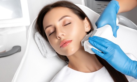 Full Face: One Session of IPL Skin Revitalisation or Medical Grade Peel