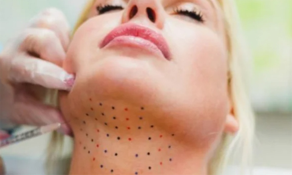 Target and Reduce Double Chin Fat with Kybella at Medspa California
