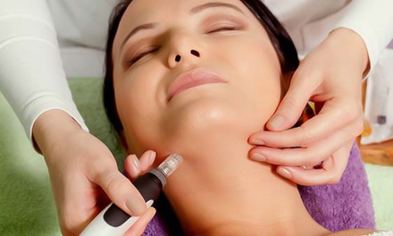 1 séance de soin microneedling