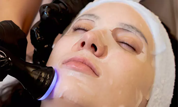 Get Your Glow Back with Facial Micro-Needling Exosomes in Edinburgh