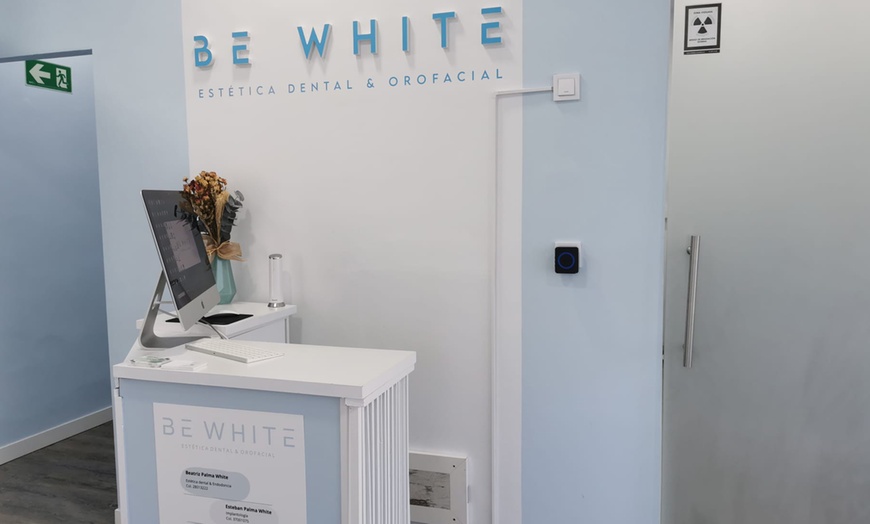 Image 8: Limpieza bucal o blanqueamiento LED con revisión, pulido y radiografía