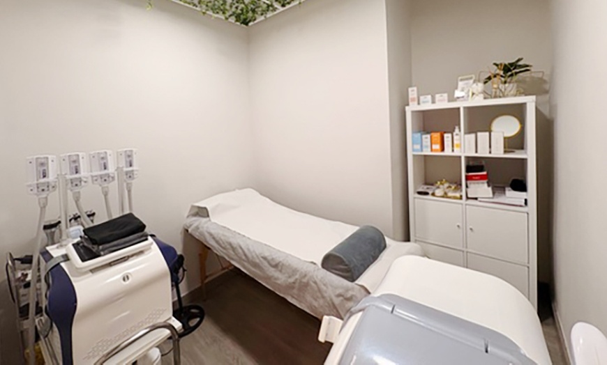 Image 1: Limpieza facial con peeling y radiofrecuencia
