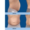 Image 10: Fat Buster or The Works – Body Consultation, Analysis, or More