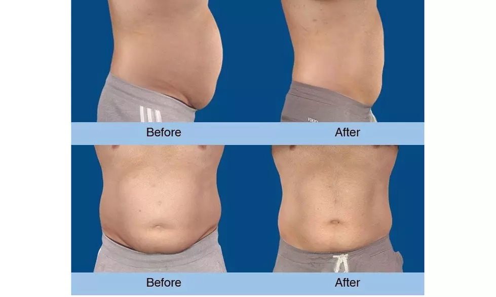 Fat Buster or The Works – Body Consultation, Analysis, or More