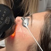 Image 1: Revitalize with Lumecca IPL for Full Face, Neck and Chest