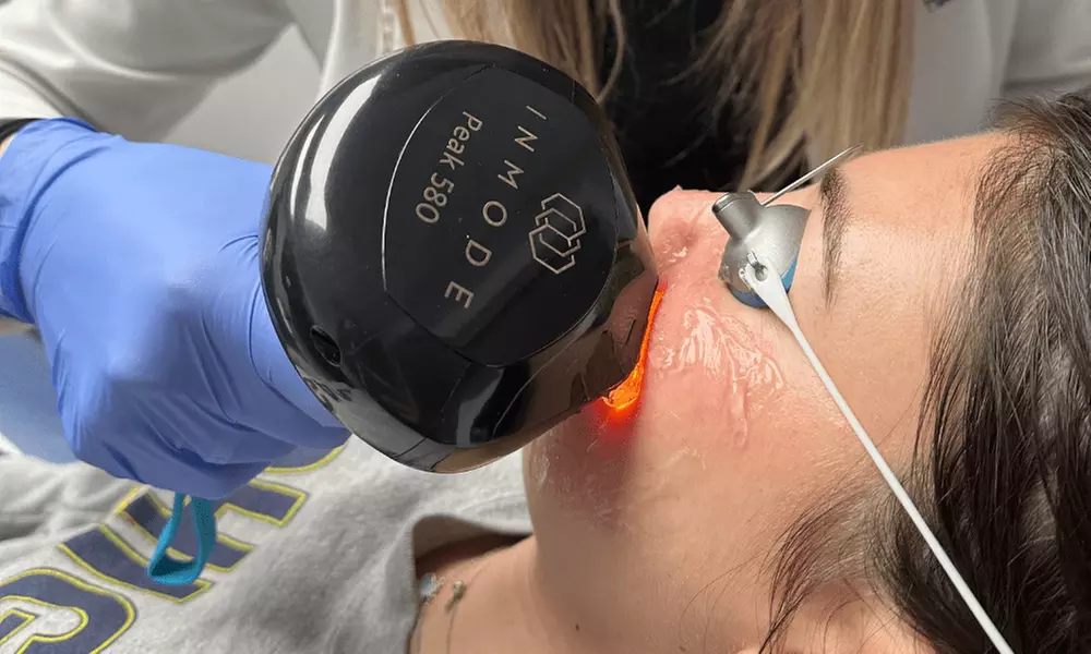 Enhance with Lumecca IPL for Full Face, Neck,and Chest at SKINnovative Medical Aesthetics Solution(Up to 63%Off) - Primary Image