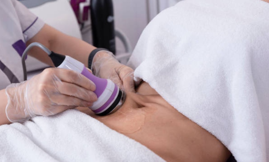 Image 14: 1, 2 o 4 sesiones de radiofrecuencia facial o corporal con masaje